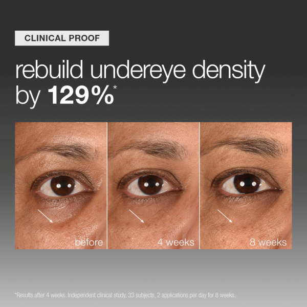 Smart Eye Density