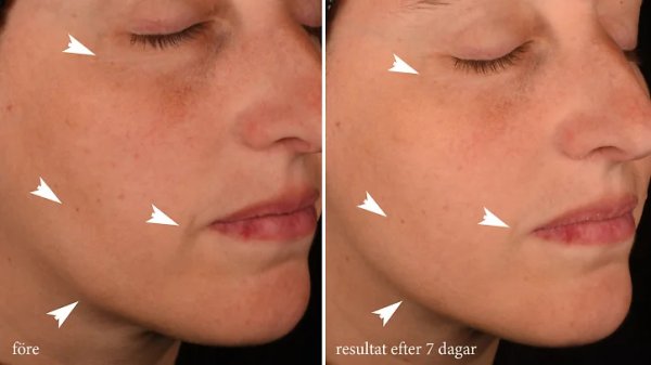 Pro - Collagen - Banking - Serum