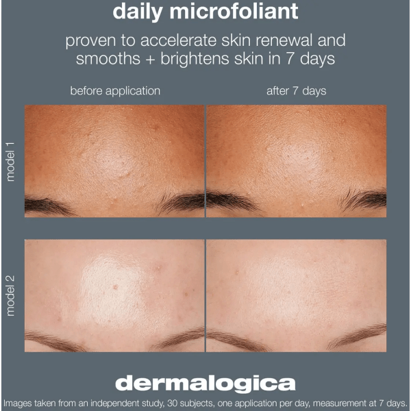dermalogica-dailyi-microfoliant-peeling