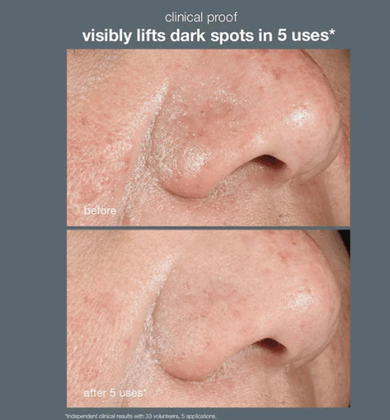 PowerBright - Dark - Spot - System