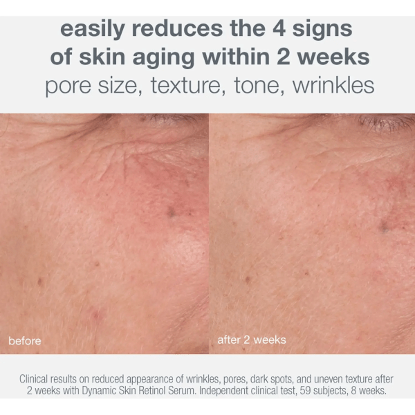 Skin Aging Solutions Age Smart